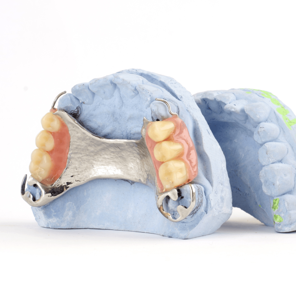 partial dentures