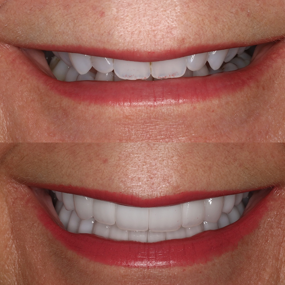 cynthia-before-after