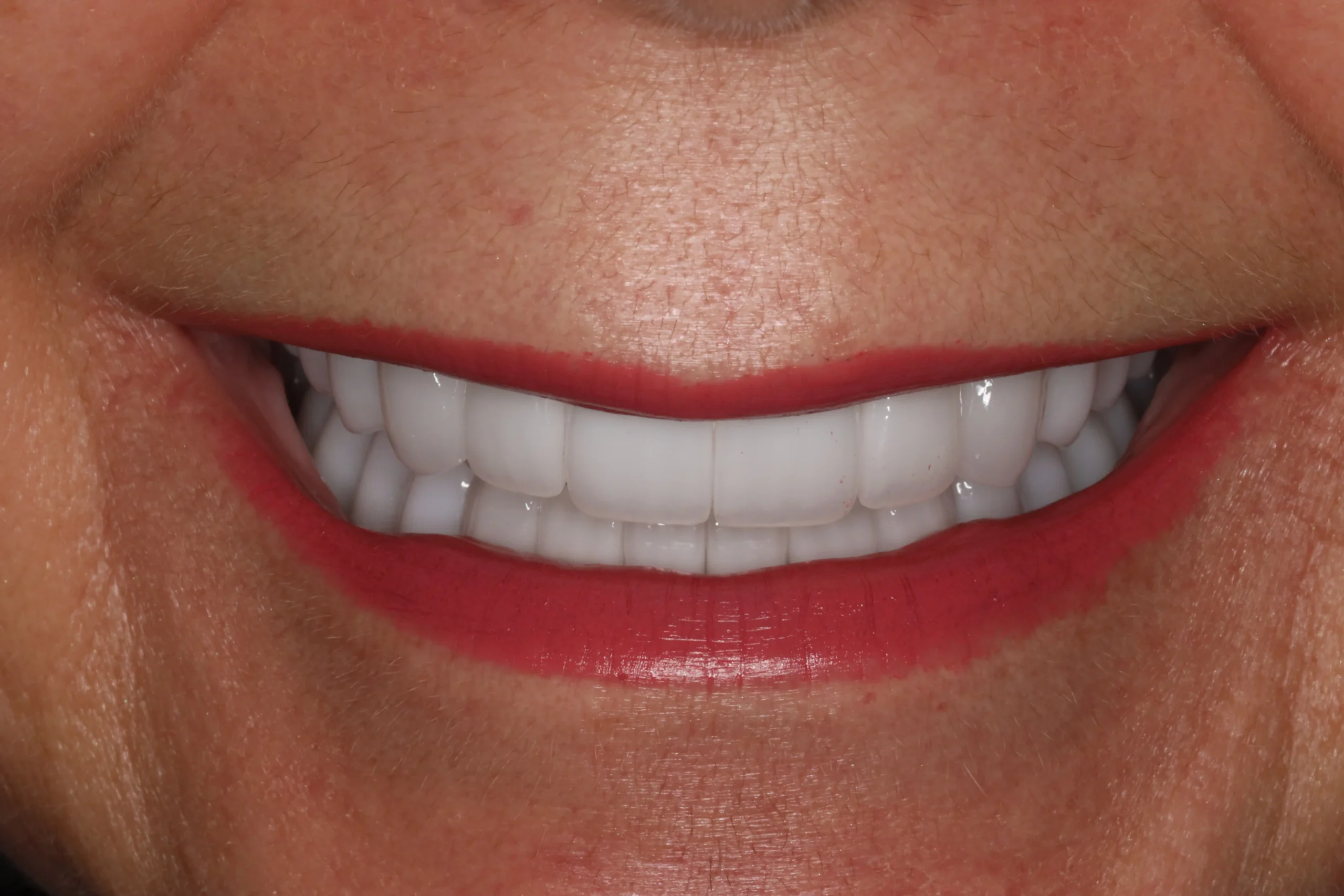 Cynthia After3 scaled