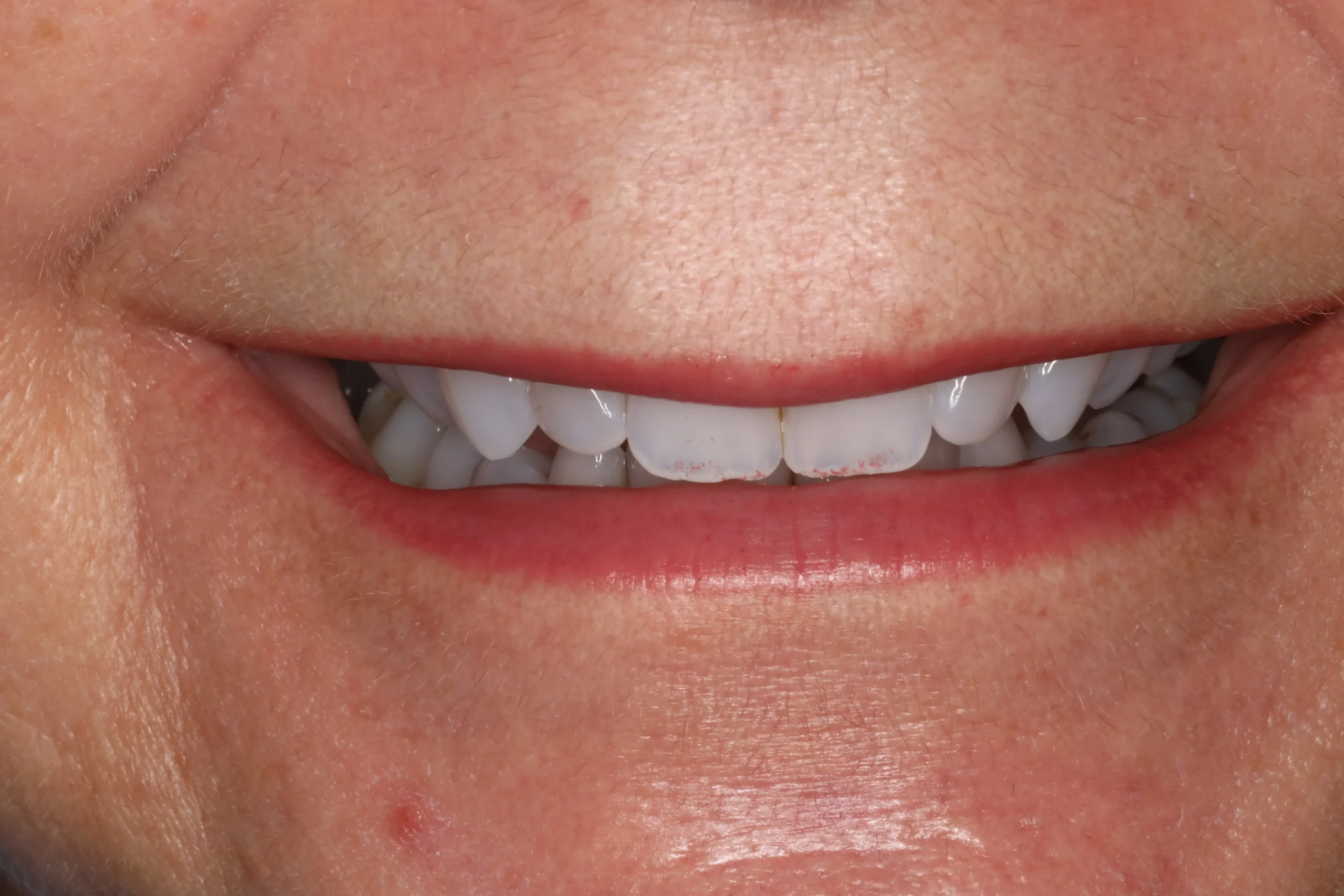 Cynthia Before3 scaled