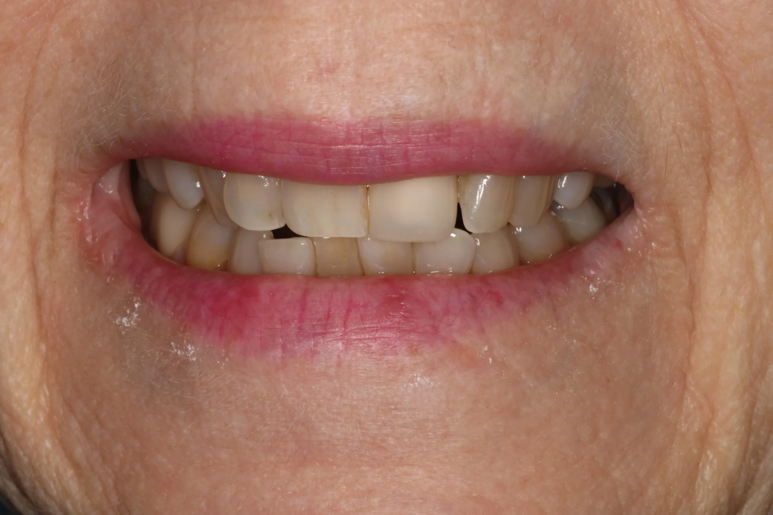 DJ West Before3 scaled