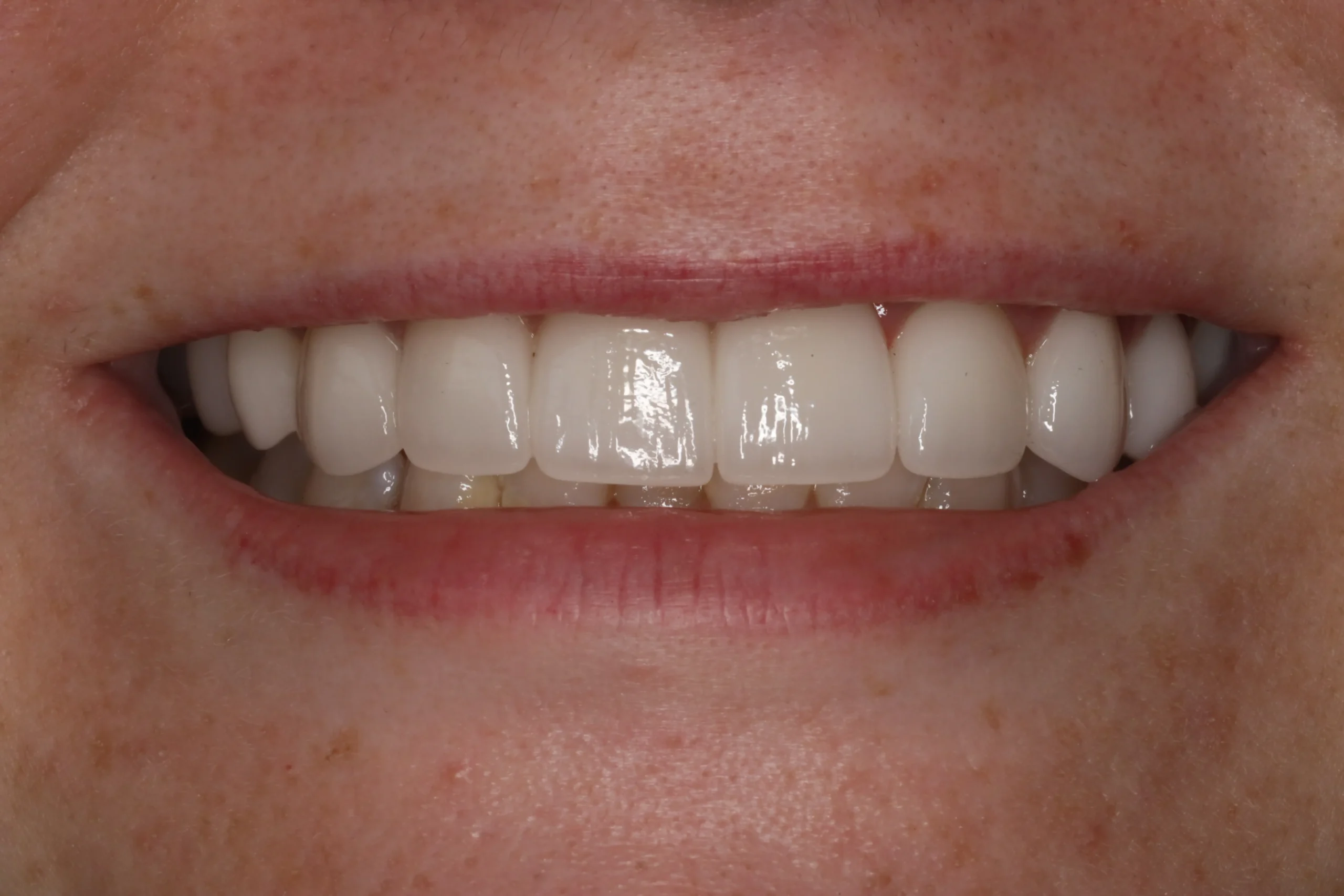 Emily Afters3 scaled