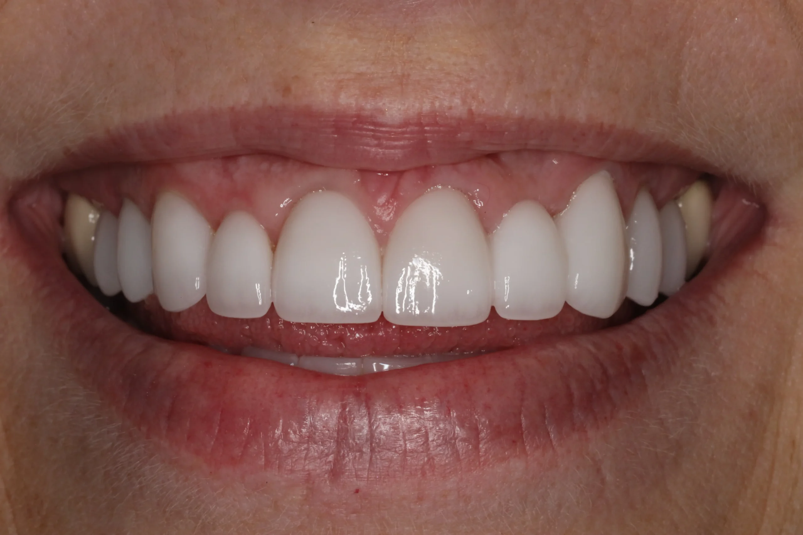 Michelle After scaled