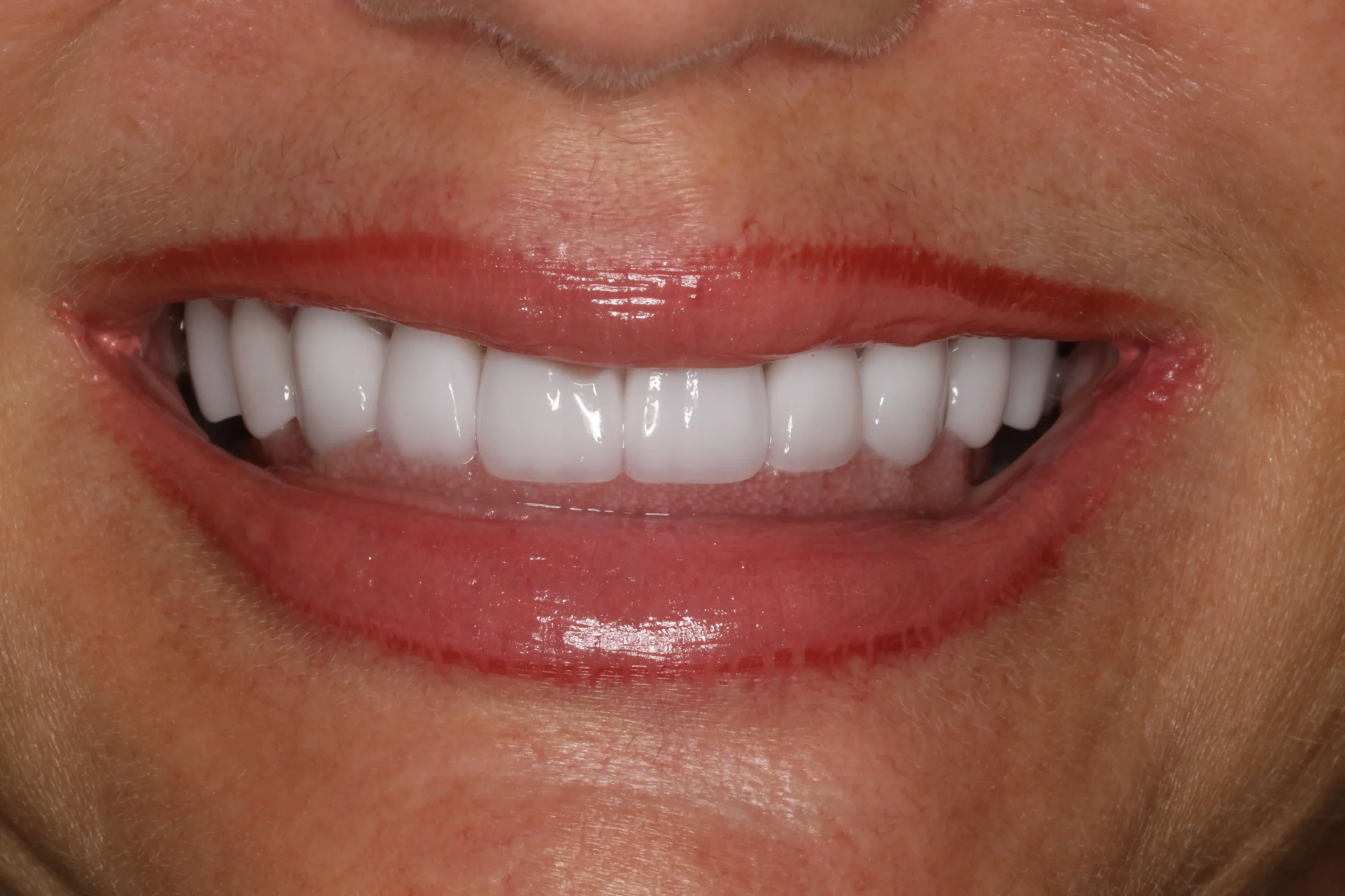 Shannon After1 scaled